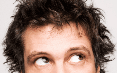 What is the Success Rate for PRP Hair Restoration?