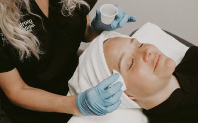 Find Out Which Chemical Peel is Right for You