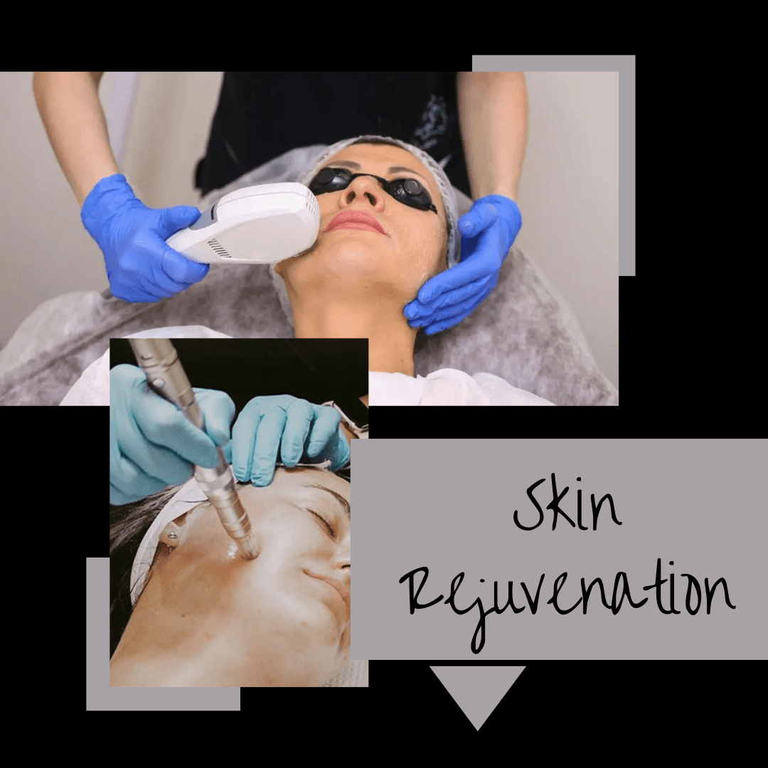 Skin Rejuvenation Elan Skin And Laser 