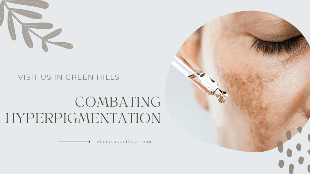 Combating Hyperpigmentation