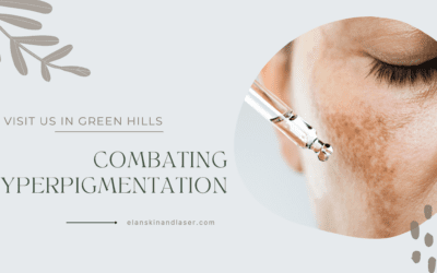 Achieving Radiant Skin: Strategies for Combating Hyperpigmentation