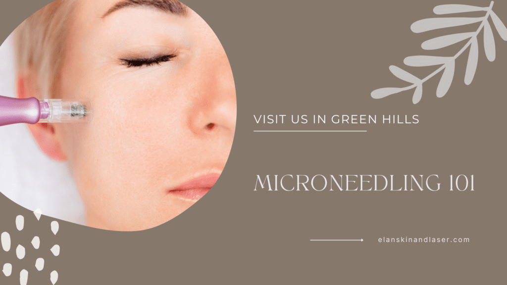 Microneedling 101