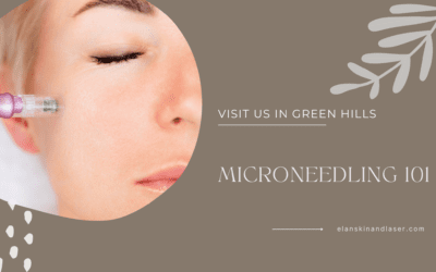 Microneedling 101: How This Treatment Transforms Skin for a Youthful Glow