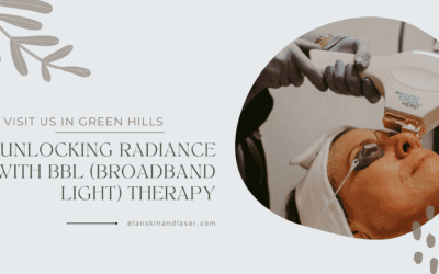 Unlocking Radiance with BBL (Broadband Light) Therapy at Elan Skin